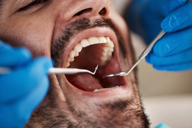 Best Broken or Cracked Tooth Emergency Dentist in Ontonagon, MI
