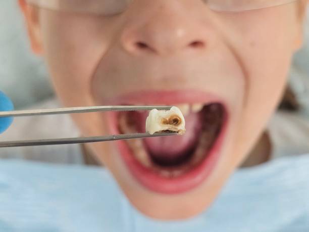 Best Urgent Dental Care for Toothache in Ontonagon, MI